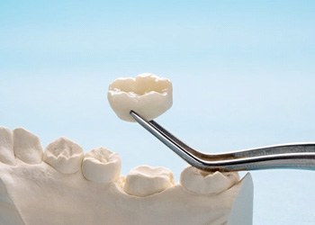 a dental crown raised atop a wax model of teeth