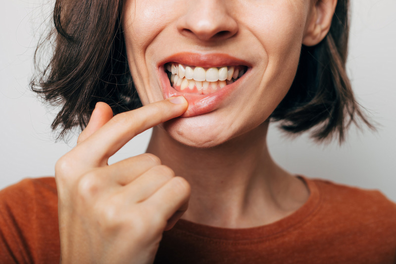 Patient asking for teeth whitening treatments at the dentist